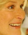 glenn close